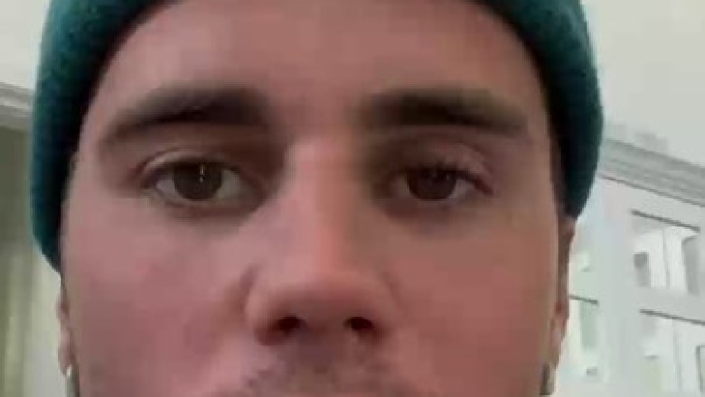 Justin Bieber postpones tour after syndrome leaves his face partially paralyzed