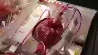 Beating Heart out side body