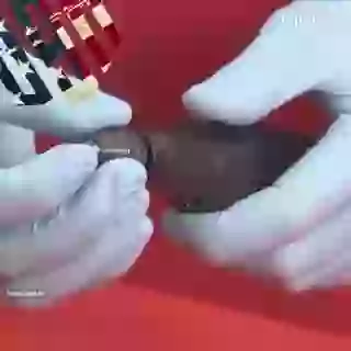 Windscreen Repair System WOW